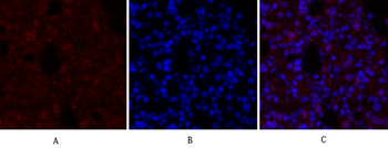 BRCA1 Polyclonal Antibody