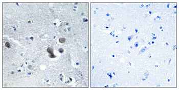 BIG2 Polyclonal Antibody