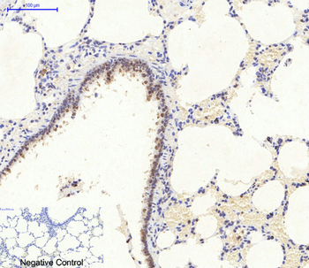 AMPKα1/2 Polyclonal Antibody