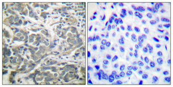 AMPKα1/2 Polyclonal Antibody