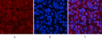 Akt Polyclonal Antibody
