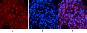 Akt Polyclonal Antibody