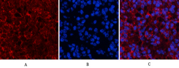 Akt Polyclonal Antibody