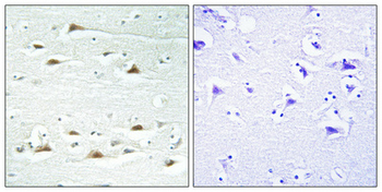 Actinin-α1/2/3/4 Polyclonal Antibody