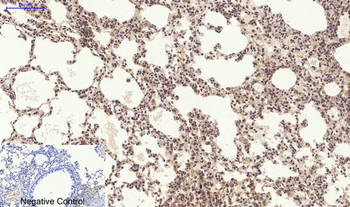 PERK (phospho Thr981) Polyclonal Antibody