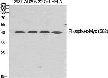 c-Myc (phospho Ser62) Polyclonal Antibody
