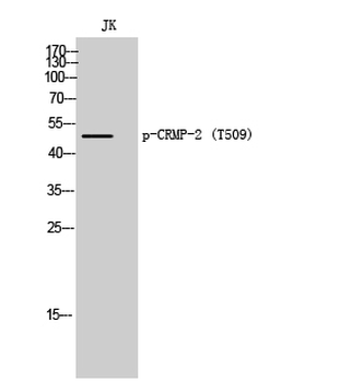 CRMP-2 (phospho Thr509) Polyclonal Antibody