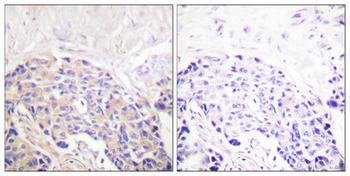 PLC γ1 (phospho Tyr771) Polyclonal Antibody
