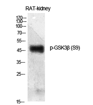 GSK3β (phospho Ser9) Polyclonal Antibody