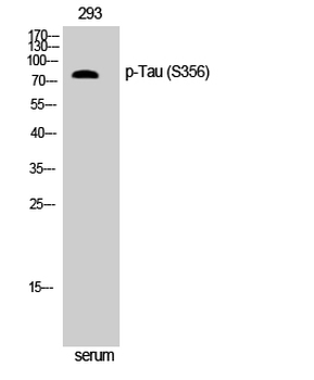 Tau (phospho Ser356) Polyclonal Antibody