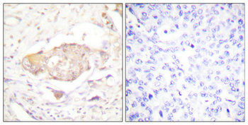 SGK1 (phospho Ser422) Polyclonal Antibody
