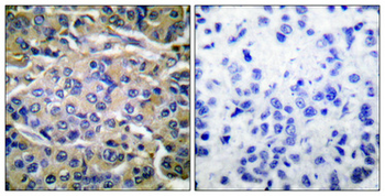 p70 S6 kinase α (phospho Thr421) Polyclonal Antibody