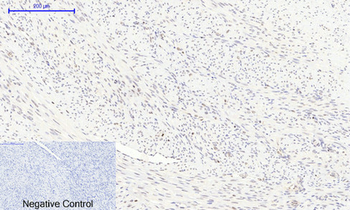 mTOR (phospho Ser2448) Polyclonal Antibody
