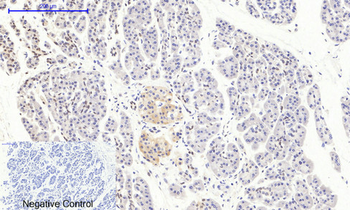mTOR (phospho Ser2448) Polyclonal Antibody
