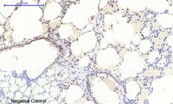 mTOR (phospho Ser2448) Polyclonal Antibody