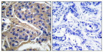 IRS-1 (phospho Ser307) Polyclonal Antibody