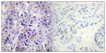 IRS-1 (phospho Ser307) Polyclonal Antibody