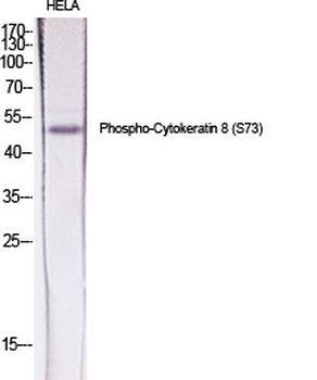 Cytokeratin 8 (phospho Ser73) Polyclonal Antibody