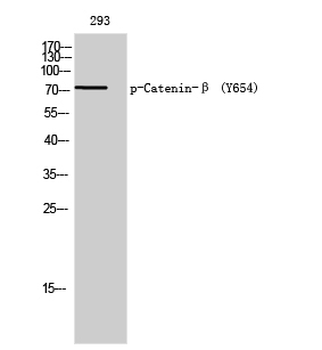 Catenin-β (phospho Tyr654) Polyclonal Antibody