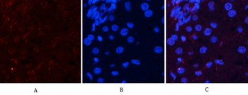 Akt (phospho Ser473) Polyclonal Antibody