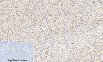 Akt (phospho Ser473) Polyclonal Antibody