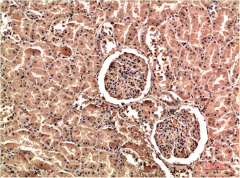 VEGF Rabbit Polyclonal Antibody