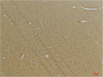 GABA B Receptor 2 Polyclonal Antibody