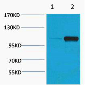 PEPC (Phospho Ser15) Polyclonal Antibody