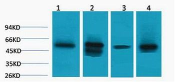LDHD Polyclonal Antibody