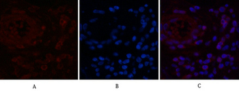 NFkB p65 Monoclonal Antibody(5G6)