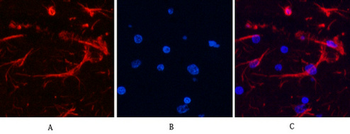 GFAP Monoclonal Antibody(5C8)