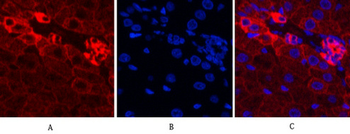 CK16 Monoclonal Antibody(6F6)