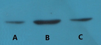 Bcl-2 Monoclonal Antibody(6B5)