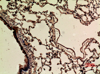 Nrf2 (Acetyl Lys599) Polyclonal Antibody