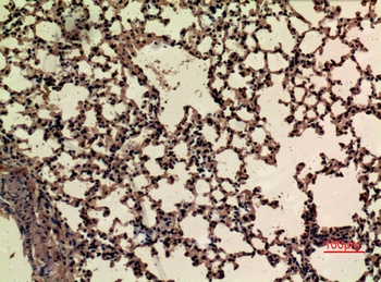 Nrf2 (Acetyl Lys599) Polyclonal Antibody