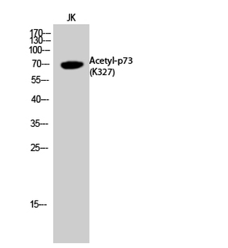 p73 (Acetyl Lys327) Polyclonal Antibody
