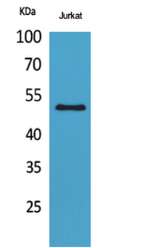HNF-3α/β/γ (Acetyl Lys264/253/211) Polyclonal Antibody