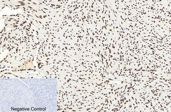 Histone H3 (Acetyl Lys9) Polyclonal Antibody