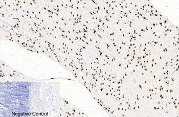 Histone H3 (Acetyl Lys9) Polyclonal Antibody