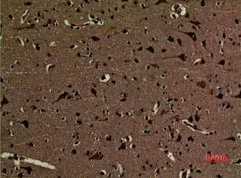 Histone H3 (Di Methyl Lys5) Polyclonal Antibody