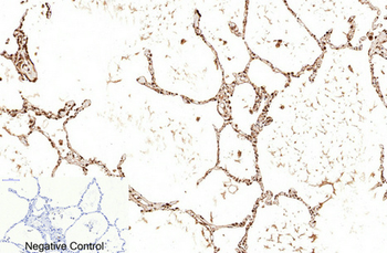 Cleaved-PARP-1 (D214) Polyclonal Antibody