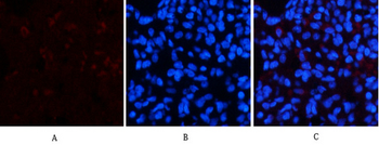 Cleaved-Notch 2 (D1733) Polyclonal Antibody
