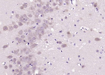 PAFAHG Polyclonal Antibody