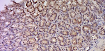 C17orf97 Polyclonal Antibody
