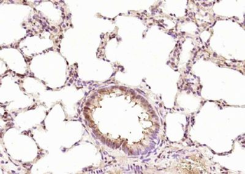 RPUSD2 Polyclonal Antibody