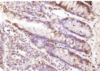 RPUSD2 Polyclonal Antibody