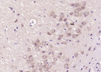 CAF1p55/VPRBP Polyclonal Antibody