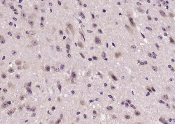 MAP7D1 Polyclonal Antibody