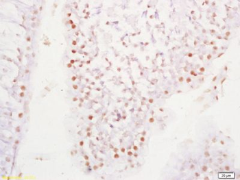 RNF40 Polyclonal Antibody