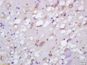 NETO1 Polyclonal Antibody